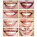 iSmile Teeth Whitening Pen (2 PACK), 35% Carbamide Peroxide Gel, 30+ Whitening Treatments, For Sensitive Teeth, Refill Kit, Pure Pearl White, Made in USA - by iSmile California (2 pens)