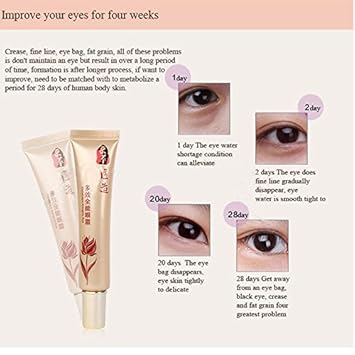 under eye whitening