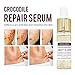 Crocodile Repair Face Serum for Acne Scars, Anti-Aging - Treats Acne, Wrinkles, Stretch Marks - Lightens Old Scars, Removes New Scars - for Men and Women