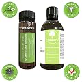 TreeActiv+ Tea Tree Oil Acne Solution for Advanced Acne Treatment â˜… All Natural Acne Spot Treatment â˜… Blemishes Gone