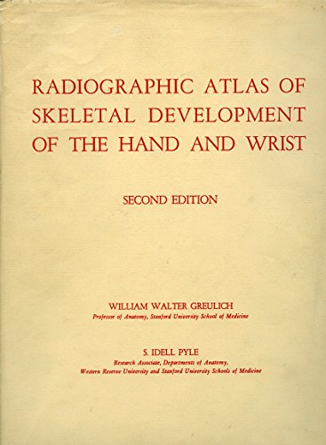 Download Radiographic Atlas of Skeletal Development of the Hand and Wrist
