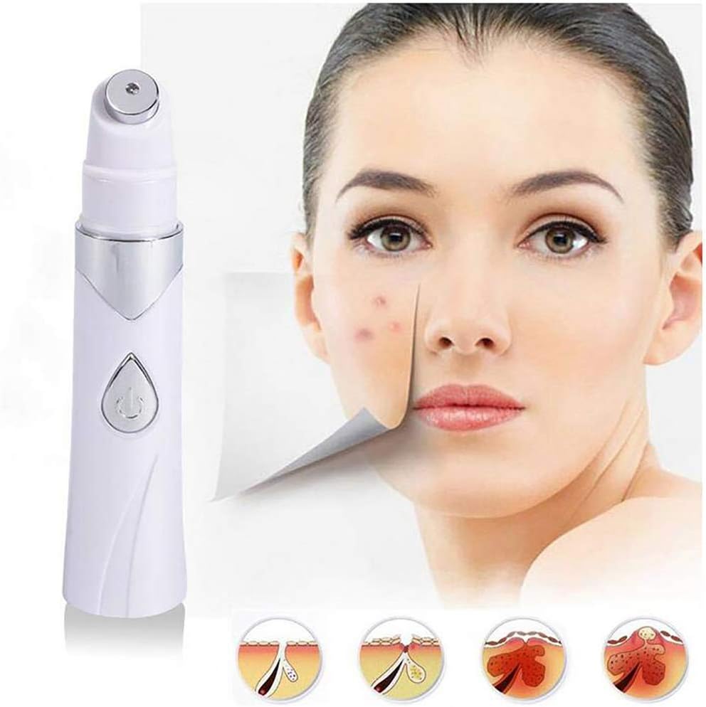 Spider Vein Eraser Blue Light Face Acne Scar Removal Machine Acne Pen Improve Skin Elasticity, Skin Tightening Wrinkle Removal Treatment