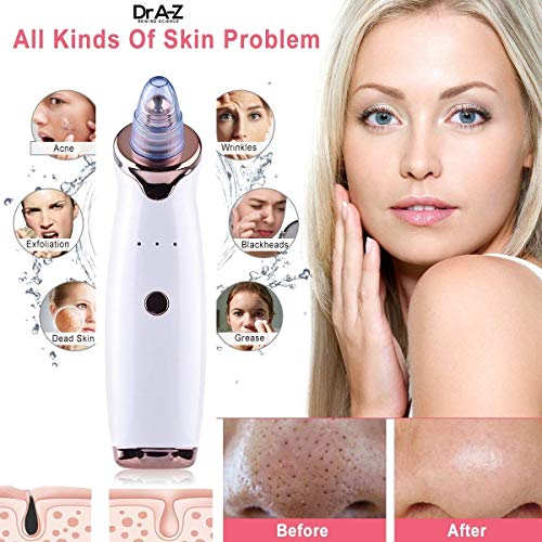 Blackhead Remover, Pore Vacuum Electric Pimple Vacuum Extractor Clean Tool - Comedo Pore Extractor Beauty Device Whitehead Pore Cleaner Suction Cleanser Microdermabrasion Blackhead sucker