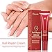 Fungus Stop,Nail Antifungal Treatment,Nail Fungus Treatments,Anti Fungus Nail Treatment,Nail Care Treatment of Anti-Fungal Cream,Effective Against Nail Fungus,Restores Toenail Fungus