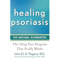 Healing Psoriasis: The Natural Alternative