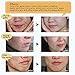TCM Scar Cream-Acne Scar Removal Cream-Skin Repair Scars Burns Cuts Pregnancy Stretch Marks-Acne Spots Acne Treatment Blackhead Whitening Cream Stretch Marks for Body