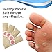 Wart Remover, Corn Remover Pads, Foot Corn Removal Plaster with Hole, Professional Removes Common and Plantar Warts, Callus, Soften Skin Cutin Sticker Cure Toe Protector,Stops Wart Regrowth 24 Pcs/Boxthumb 2