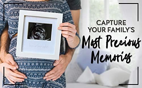 Sonogram Picture Frame White Wooden Baby Ultrasound Photo Frames Cute Nursery Decor Pregnancy Gifts For First Time Moms Announcement For Expecting Parents To Be Keepsake For New