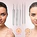 Blackhead Remover Kit Tool ULG Comedone Extractor Tool Set 5Pcs Professional Stainless Steel Tweezers Kit Pimple Removal Treatment for Whitehead Blemish Acne