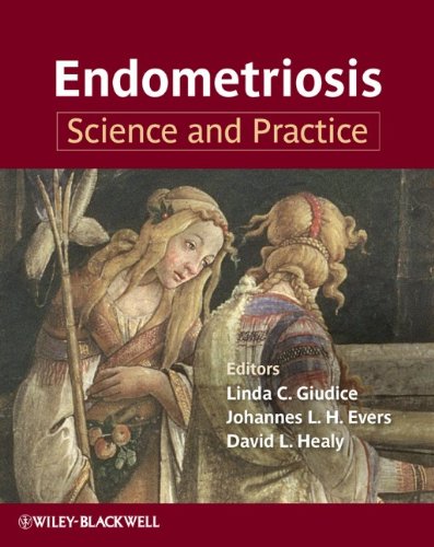 Endometriosis - Science and Practice