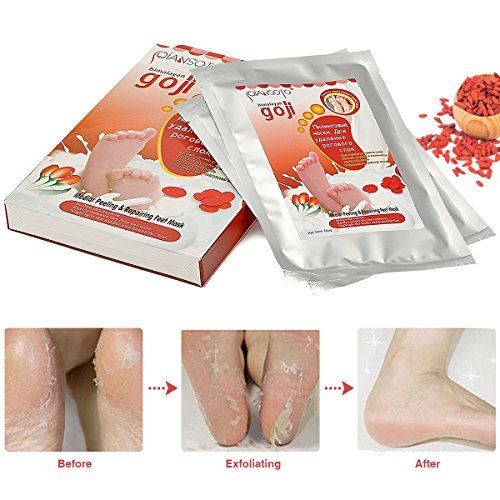 Wolfberry Foot Peeling Mask for Baby Soft Feet - 2 Pairs Ultra Repairing Feet Mask, Exfoliate Dry Dead Skin, Foot Treatment, Calluses Remover, Repair Rough Heels by Himalayan Wolfberry
