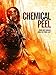 Chemical Peel