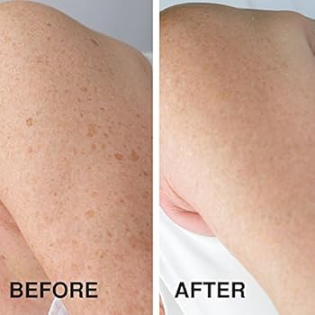 miracle fade skin lightening cream