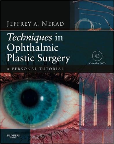 Techniques In Ophthalmic Plastic Surgery A Personal Tutorial Kindle Edition By Nerad Jeffrey A Professional Technical Kindle Ebooks Amazon Com