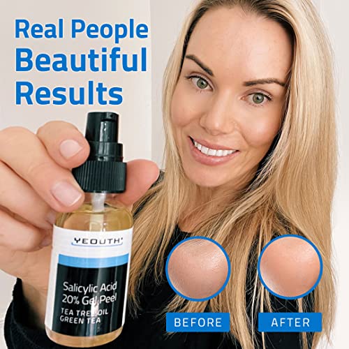 Salicylic Acid Gel Peel for Face, Bha Exfoliant for Acne, Dark Spot