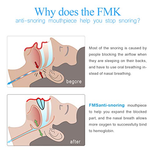 image for FMS Anti Snoring Devices Mouthpiece,FMK Mouth Guard Adjustable Comfort