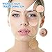 Blackhead Remover, Eitpoton Electric Blackhead Vacuum Suction Removal, Acne Comedone Extractor Tool Set, Skin Facial Pore Cleaner, Comedo Microdermabrasion Exfoliating Machine for Women and Men
