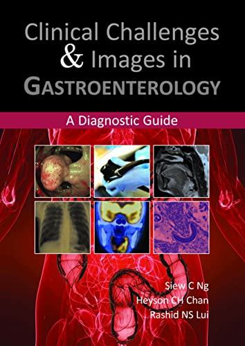 Clinical Challenges and Images in Gastroenterology: A Diagnostic Guide