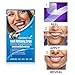 MitButy Teeth Whitening with Natural Coconut Oil, 28 Non-Slip White - Professional Safe Effects, 14 Treatments
