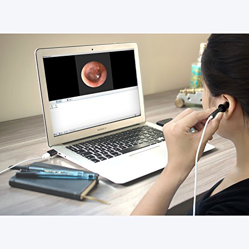 3 ScopeAround+Inspection+Professional+Endoscope+Adjustable