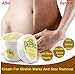 Pasjel Cream For Stretch Marks And Scar Removal Powerful To Stretch Marks Maternity Skin Body Repair Cream