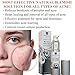 Blemish Spot Treatment Cream - Gentle Serum for Redness and Breakouts for Face, Back, and Body - Revive Your Confidence with Clear Skin