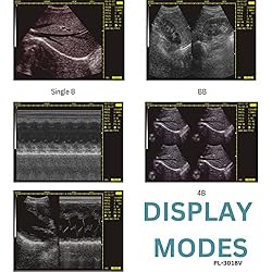 2023 Convex Newest Ultrasound Machine for Pregnancy