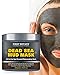 100% Natural Mineral-Infused Dead Sea Mud Mask 8.8 oz for Facial Treatment, Skin Cleanser, Pore Reducer, Anti Aging Mask, Acne Treatment, Blackhead Remover, Cellulite Treatment & Natural Moisturizer