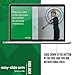   Compression Sleeve Arm Donning Aid for Men & Women | Frustration Reducing Donner For All Compression Sleeves: Medical, Shapers, Athletic and More | Arion Easy Slide Arm