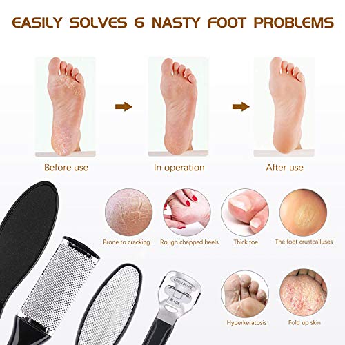 Professional Pedicure Kit 18 in 1, Inpher Stainless Steel Rasp Foot Double Sided Files and Callus Clean Feet Dead Skin Tool Set, Nail Toenail Clipper Foot Care Kit for Women Men Salon or Home