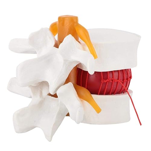 Oumefar 1:1.5 Medical Teaching Demonstration Model of Lumbar Vertebral ...