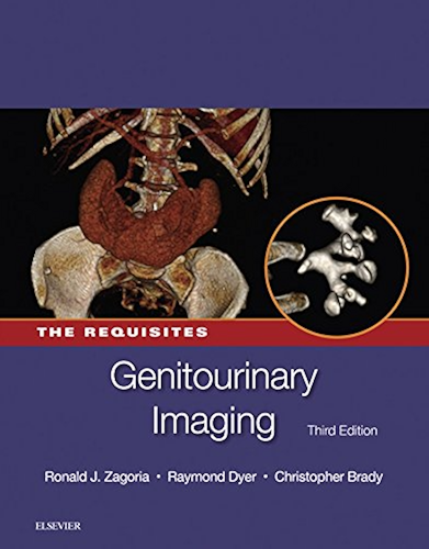 Download Genitourinary Imaging: The Requisites E-Book (Requisites in Radiology) (English Edition) PDF
