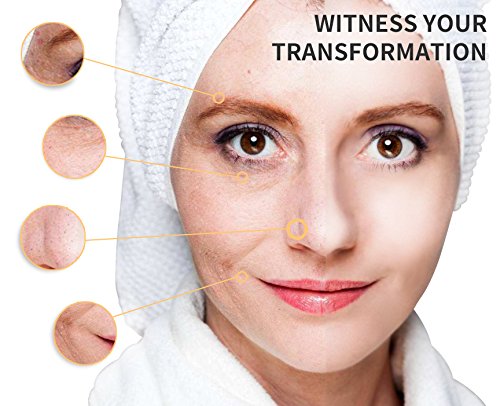 Blackhead Remover Blackhead Vacuum Cleanser, AIKOTOO Pore Vacuum Suction Remover—Blackhead Extractor Tool Set with 4 Replaceable Suction Heads, Facial Blackhead Vacuum …