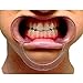 EZGO 20 Pack (10 Medium + 10 Large) C-Shape Cheek Retractor, Autoclavable Dental Mouth Opener, Disposable Dental Lip Retractor for Mouthguard Challenge Game
