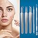 5 PCS Acne Remover Tool Kit, Stainless Steel Comedone Extractor Tools Set with Metal Case,Blackhead Removal Tweezers Kit, Treatment for Pimple, Blemish, Whitehead Popping Removing, Silver