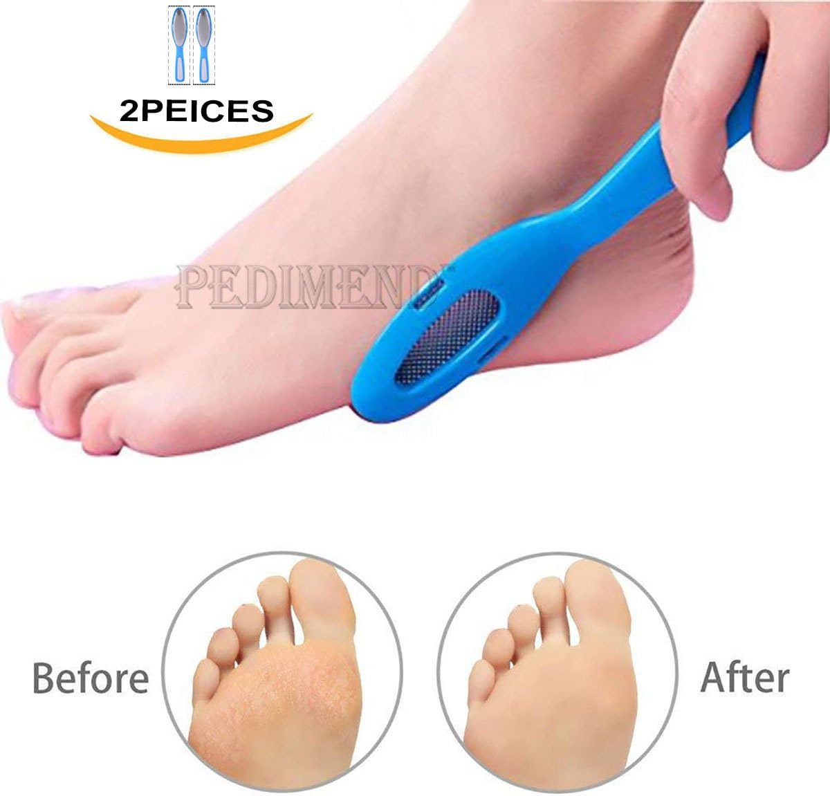 PEDIMEND™ Stainless Steel Foot File Pedicure Rasp Callus Remover 2PCS | Pedicure Tools | Foot Exfoliating Scrubber Cleaner File | Dead or Hard Skin Remover | for Men & Women | Foot Care (Blue)