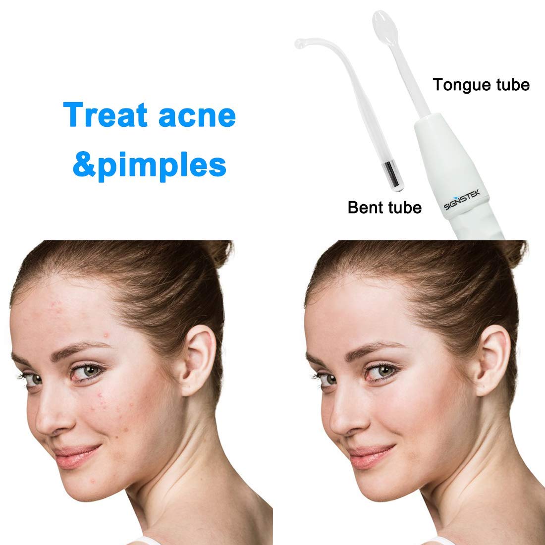 Signstek Portable High Frequency Face Wand Facial Machine for Skin Tightening, Acne Wrinkles Remover, Puffy Eyes: Beauty