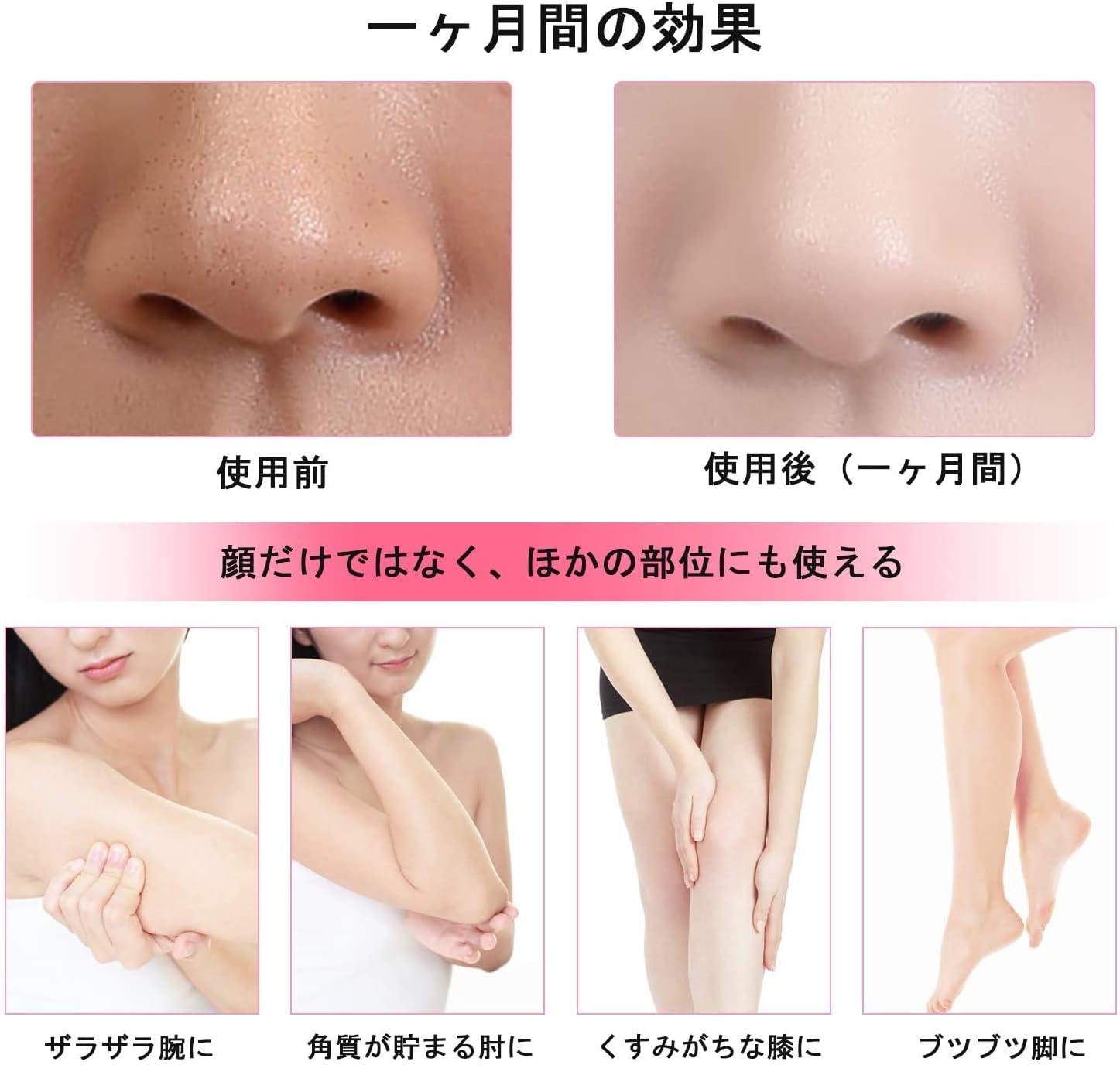 Amazon Co Jp Gjby 4色 超音波 フェイシャルエステ イオン導入計 Ems 引っ張る 皮かき機 ウォーターピーリング 超音波 毛穴ケア バレンタイン 洗顔器 ピーリング Usb充電式 角栓クリア 毛穴汚れ にきび 余分皮脂 黒ずみ吸出し 美肌効果 フェイスケア イチゴ鼻 色2