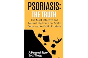 Psoriasis: The Truth: The Most Effective and Natural Diet Cure for Scalp, Body, and Arthritic Psoriasis (Psoriasis treatment psoriasis shampoo psoriasis cream psoriasis lotion)