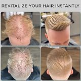 THICK FIBER Hair Fibres 25g Medium Blonde Hair Thickener for Thinning Hair view 3