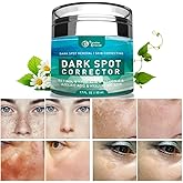 Paradise Emerald Dark Spot Remover for Face, Hyperpigmentation Treatment, Melasma, Freckle, Sun Spots Removal for All Skin Ty