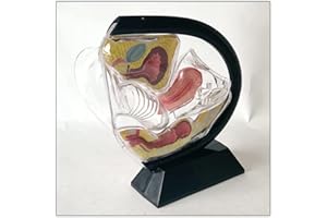 Uterine Anatomy,Transparent Uterus Model Visible Uterine Structure Pelvic Cavity Abdominal Bladder Ovarian Rectum Teaching Co