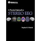 A Practical Approach to Stereo EEG