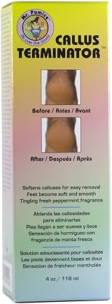 Mr. Pumice Callus Terminator Soft Smooth Skin Fast Feet Exfoliator view 2