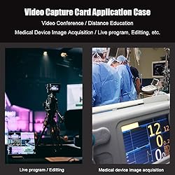 SDTNOVA HDMI SDI Video Capture USB3.0 Capture Video