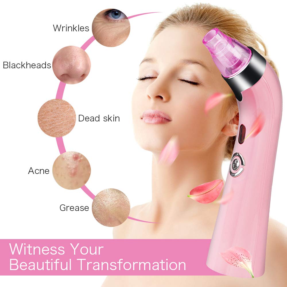 Kaufam Blackhead Remover Pore Vacuum USB Rechargeable Blackhead Suction Device Blemish Removal Tool for Women: Beauty