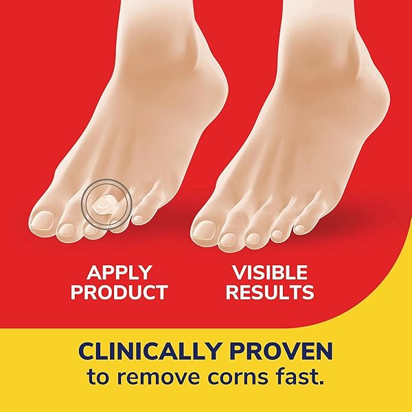 DR. SCHOLL’S CORN REMOVERS SEAL & HEAL BANDAGE WITH HYDROGEL TECHNOLOGY, 6 CT // REMOVES CORNS FAST AND PROVIDES CUSHIONING PROTECTION AGAINST SHOE PRESSURE AND FRICTION FOR ALL-DAY PAIN RELIEF