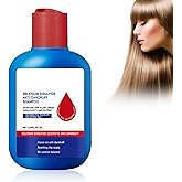 CLYXQP Anti-Dandruff Shampoo, Oil Control Formula for Men and Women, 300ml