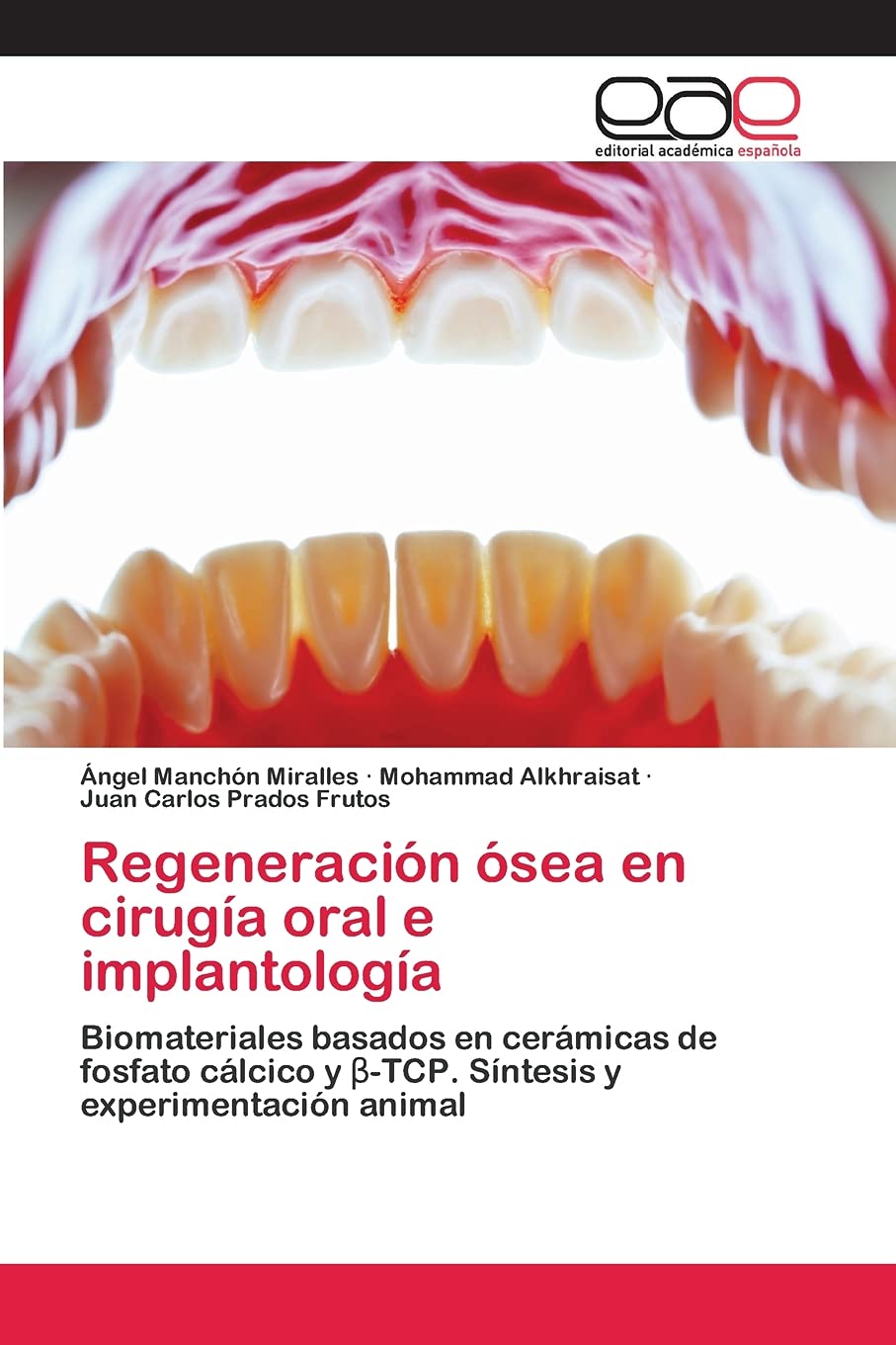 Regeneracion Osea En Cirugia Oral E Implantologia Biomateriales Basados En Ceramicas De Fosfato Calcico Y B Tcp Sintesis Y Experimentacion Animal Spanish Edition Manchon Miralles Angel Alkhraisat Mohammad Prados Frutos Juan Carlos