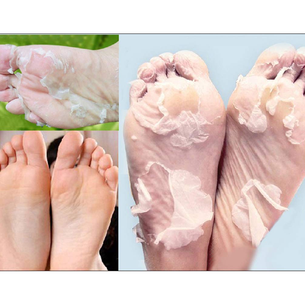 baby foot peel amazon